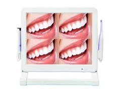 Câmera dental intra-oral de estilo wifi com 1 ou 4 telas