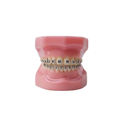 Dental Typedont Dentes Modelo Para Preparação Dental Estudante Ortodontia Prática Modelo