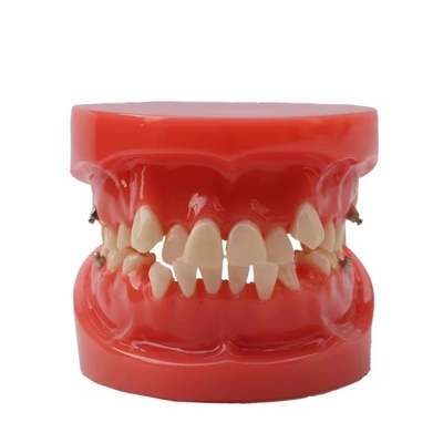 Treinamento Uso de Dentes Dentários Modelo de Ensino Modelo Ortodôntico Dental Funcional Sem Bracket
