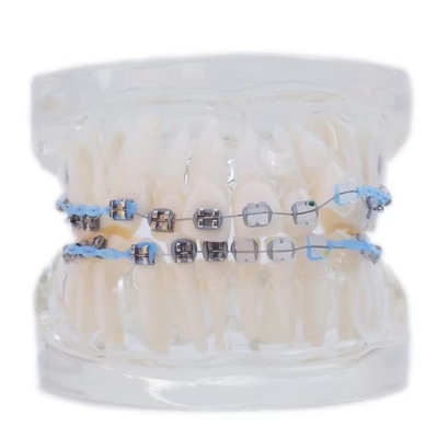 Modelo de Dentes Humanos Multicolor para Estudo Dental Modelo de Dentes Ortodônticos Com Bracket