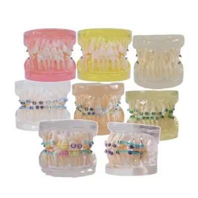 Modelo de Dentes Humanos Multicolor para Estudo Dental Modelo de Dentes Ortodônticos Com Bracket