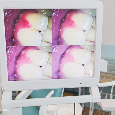 Endoscópio Dental com Monitor de 17 polegadas Wifi Câmera Dental Portátil Portátil Endoscópio Intraoral Câmera Intraoral