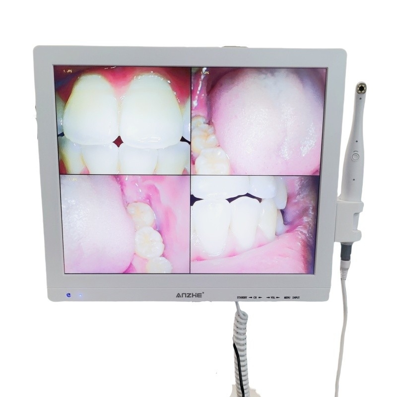 Wifi All In One câmera oral com alto-falante LCD Screen Dental Oral Camera Scanner