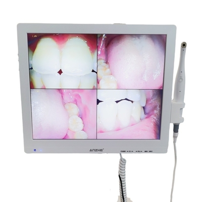 Wifi All In One câmera oral com alto-falante LCD Screen Dental Oral Camera Scanner
