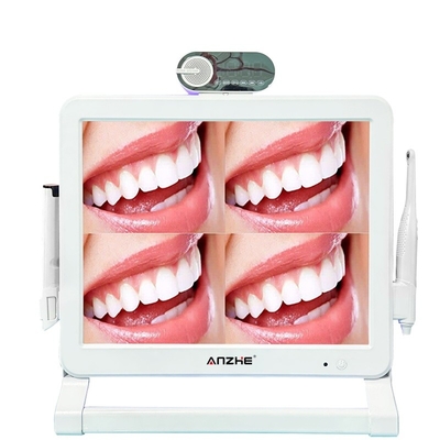 Fábrica de Foshan Wifi Dental Intraoral Camera Endoscópio Dental de Alta Definição Com Monitor